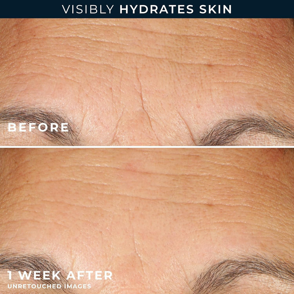 RoC, Retinol Correxion, Line Smoothing Night Serum Capsules, 30 Biodegradable Capsules