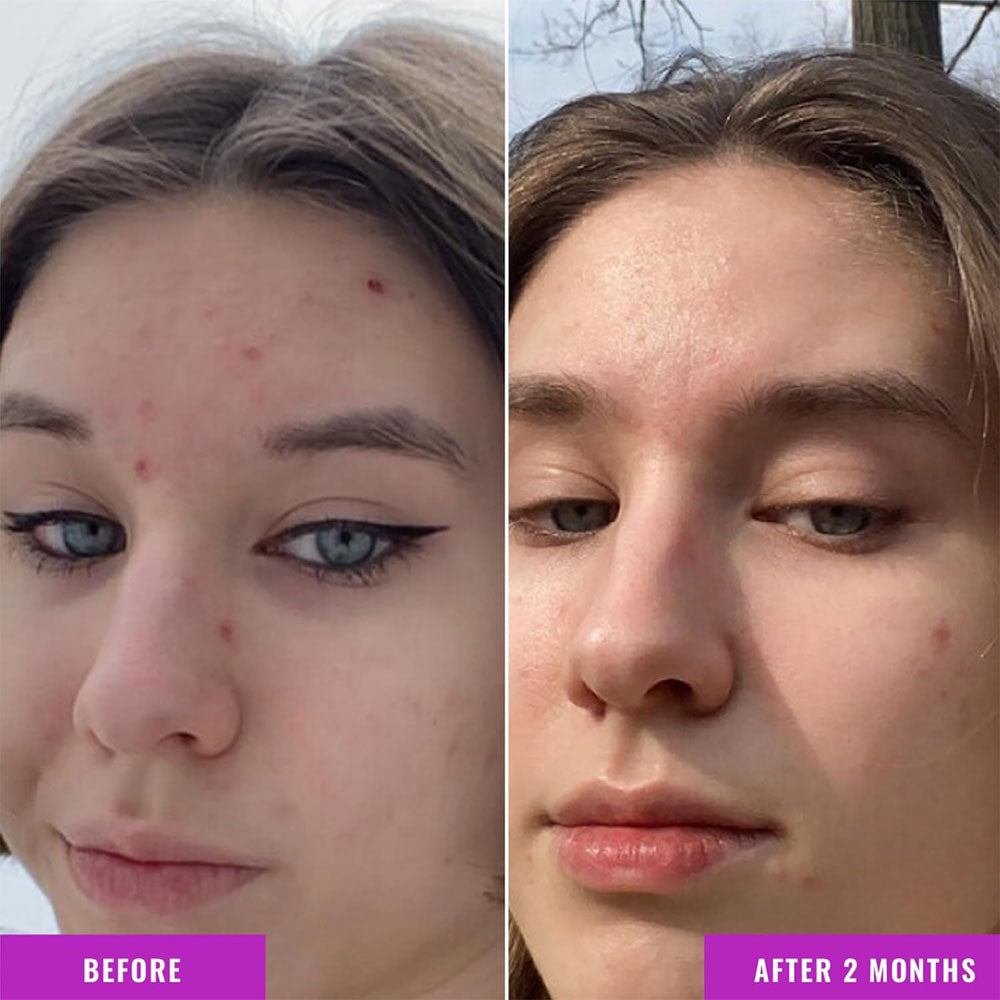 Good Molecules Niacinamide Serum - 75ml